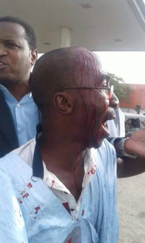 Mauritanie : plusieurs blessés dans des manifestations contre les modifications constitutionnelles Mauritanie : plusieurs blessés dans des manifestations contre les modifications constitutionnelles