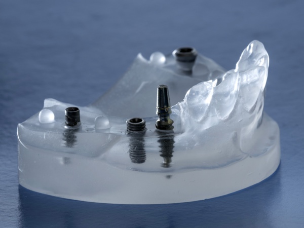 Vers une réimplantation du l’UPR : Un test, un de plus Vers une réimplantation du l’UPR : Un test, un de plus