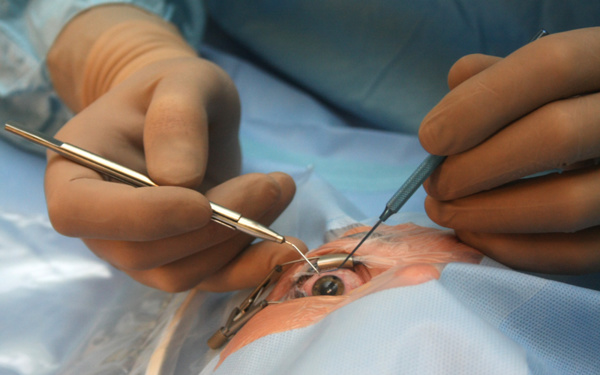 Une mission médicale chinoise effectue des opérations chirurgicales ophtalmologiques au Centre Hospitalier National