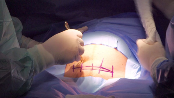 Mauritanie: "Mention très honorable" pour une thèse de doctorat sur les interventions césariennes Mauritanie: "Mention très honorable" pour une thèse de doctorat sur les interventions césariennes