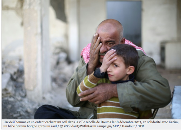 Syrie: un bébé devenu borgne après un raid, symbole sur le net Syrie: un bébé devenu borgne après un raid, symbole sur le net