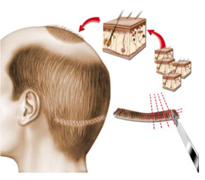 Implantation de l’UPR : Sur fond de succession ouverte Implantation de l’UPR : Sur fond de succession ouverte