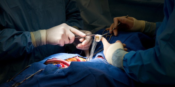 L’équipe de chirurgie cardiovasculaire sauve d’une mort subite une patiente de 29 ans