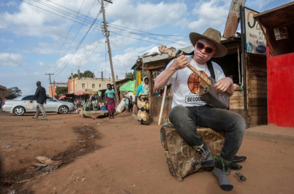 Au Malawi, un "fils" de Salif Keita au service de la cause albinos Au Malawi, un "fils" de Salif Keita au service de la cause albinos