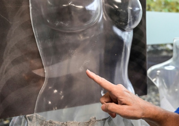 A Milan, l'exposition choc d'un hôpital pour dénoncer les violences faites aux femmes A Milan, l'exposition choc d'un hôpital pour dénoncer les violences faites aux femmes