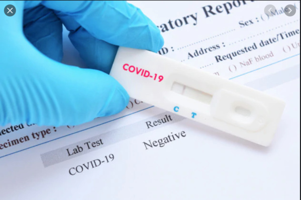 La Mauritanie effectue 79 tests de Covid-19 La Mauritanie effectue 79 tests de Covid-19