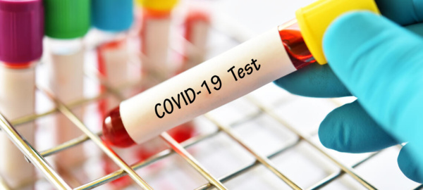 Coronavirus : la situation épidémiologique du jour en Mauritanie Coronavirus : la situation épidémiologique du jour en Mauritanie