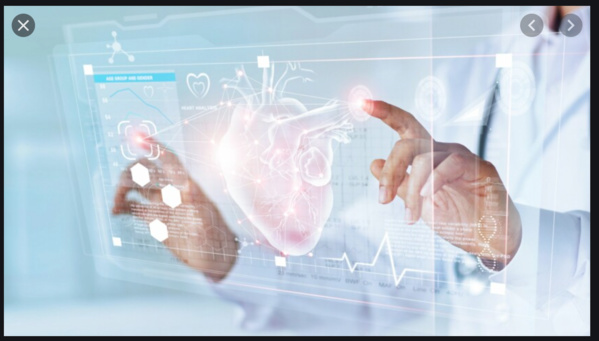 Vers un partenariat CNC et l’Ong La Chaine de l’Espoir Vers un partenariat CNC et l’Ong La Chaine de l’Espoir