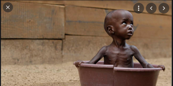 Mauritanie : 912 millions d’ouguiyas pour lutter contre la malnutrition