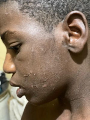 Mauritanie : Sévices sur un descendant d’esclaves, âgé de 13 ans