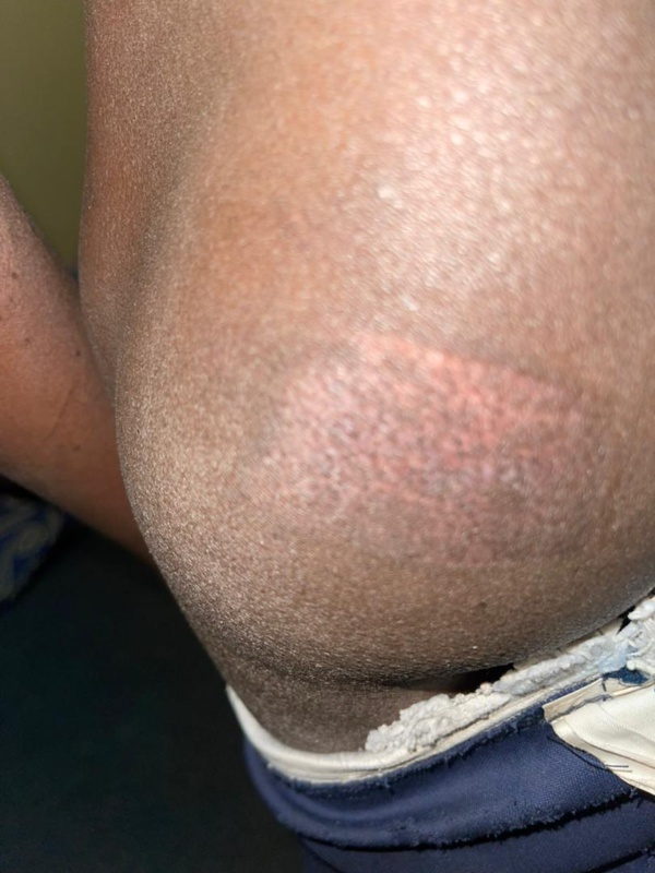 Mauritanie : Sévices sur un descendant d’esclaves, âgé de 13 ans Mauritanie : Sévices sur un descendant d’esclaves, âgé de 13 ans