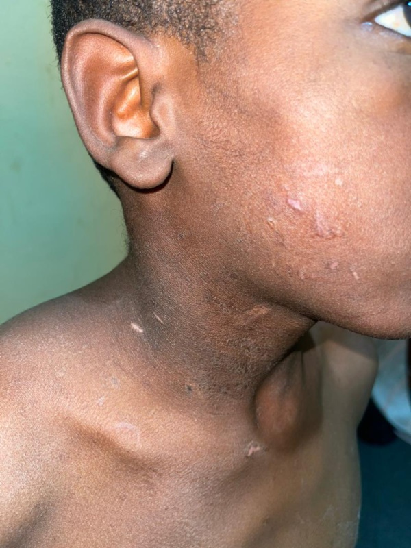 Mauritanie : Sévices sur un descendant d’esclaves, âgé de 13 ans Mauritanie : Sévices sur un descendant d’esclaves, âgé de 13 ans