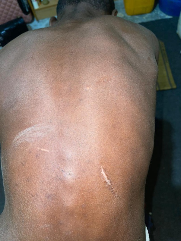 Mauritanie : Sévices sur un descendant d’esclaves, âgé de 13 ans Mauritanie : Sévices sur un descendant d’esclaves, âgé de 13 ans