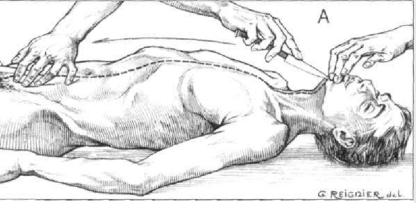 Le ministre de la Santé: Tous les spécialistes en la matière seront mobilisés pour parvenir à la vérité dans le dossier de “Banimi” Le ministre de la Santé: Tous les spécialistes en la matière seront mobilisés pour parvenir à la vérité dans le dossier de “Banimi”