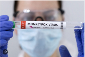 Mauritanie : simulation virtuelle face à une épidémie de variole du singe Mauritanie : simulation virtuelle face à une épidémie de variole du singe