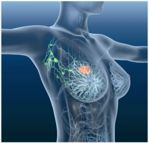 L’association caritative Ithar lance une campagne de dépistage précoce du cancer du sein L’association caritative Ithar lance une campagne de dépistage précoce du cancer du sein