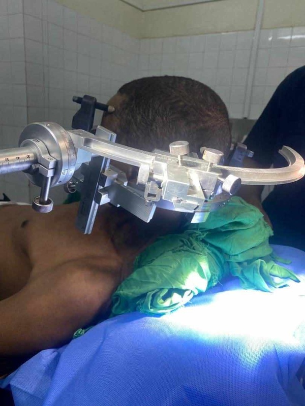 Multiples biopsies stéréotaxiques réalisées au Centre Hospitalier National de Nouakchott : une avancée rare dans la sous-région