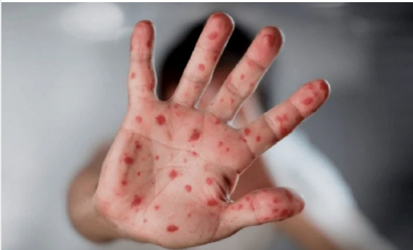 Réunion d’urgence de la direction de la médecine préventive Réunion d’urgence de la direction de la médecine préventive