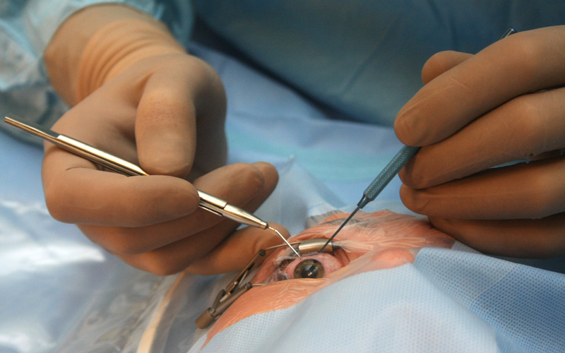 Une mission médicale chinoise effectue des opérations chirurgicales ophtalmologiques au Centre Hospitalier National