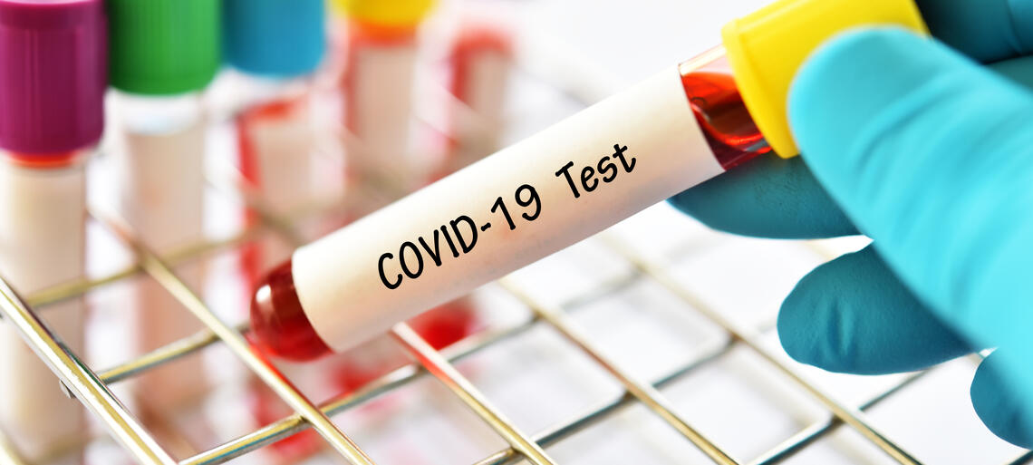 Coronavirus : la situation épidémiologique du jour en Mauritanie Coronavirus : la situation épidémiologique du jour en Mauritanie