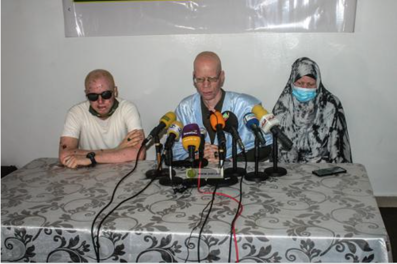 Le président de l'organisation de soutien et d'intégration des albinos : « Nous avons besoin d'une assurance maladie »