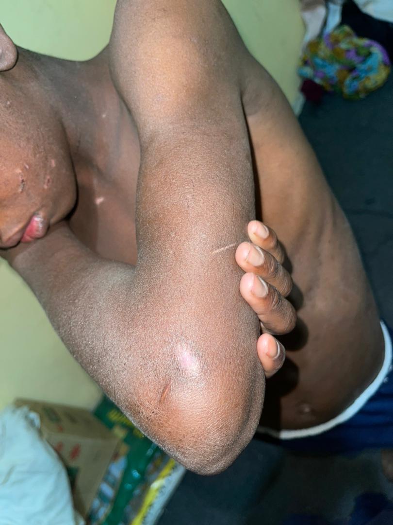 Mauritanie : Sévices sur un descendant d’esclaves, âgé de 13 ans