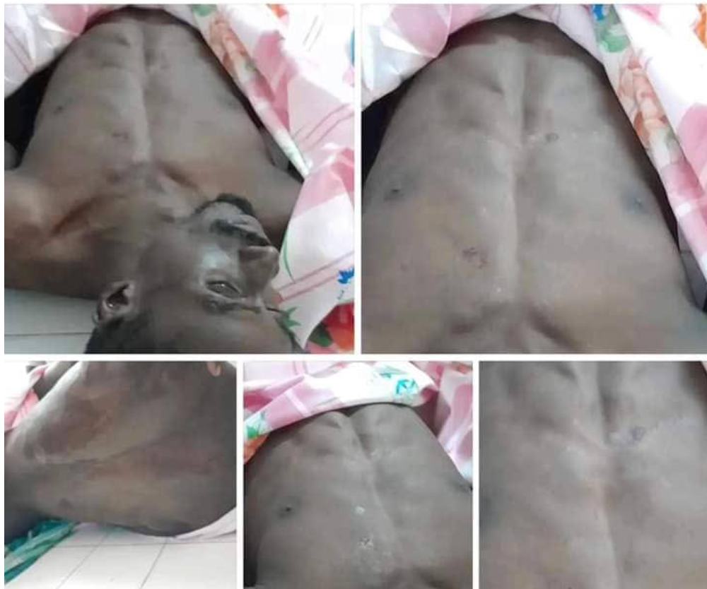 Meurtre d'Oumar Diop:  le procureur de la République à hôpital national pour l'autopsie