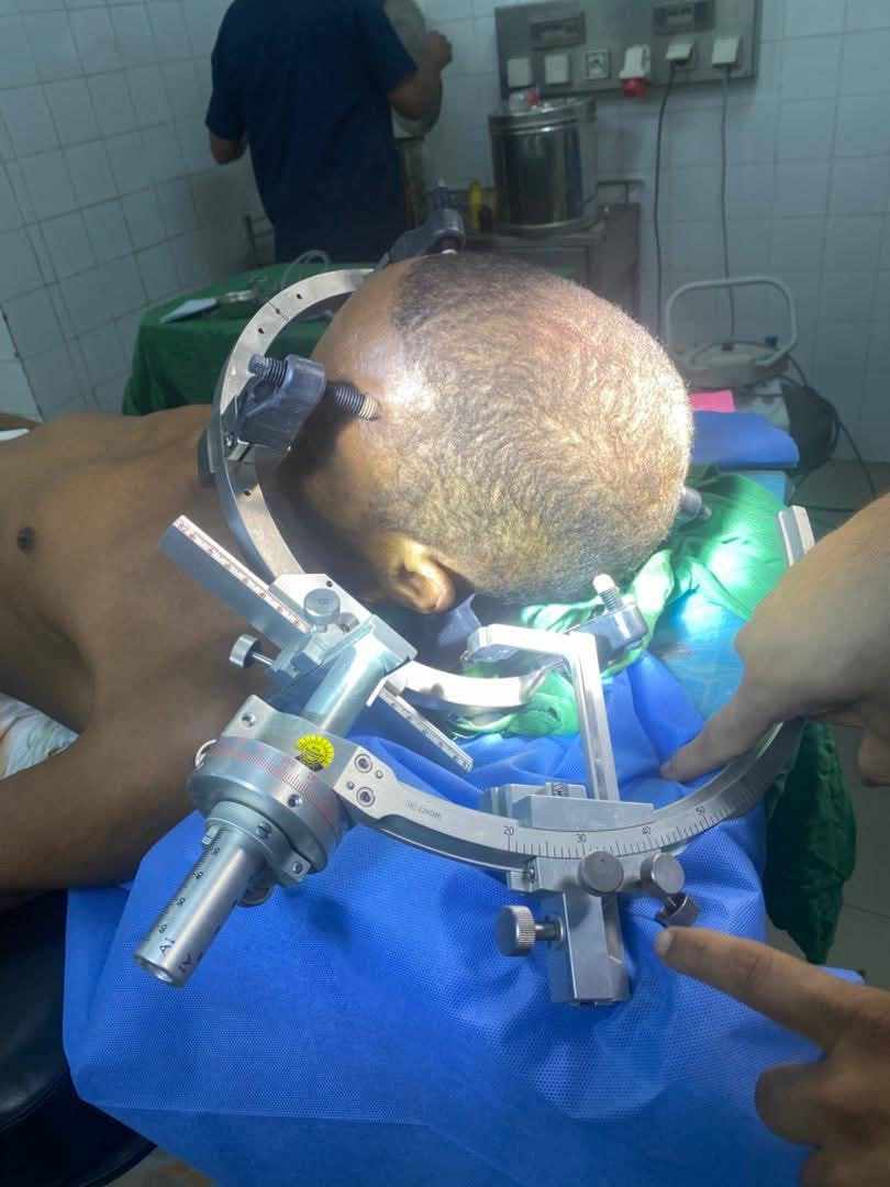 Multiples biopsies stéréotaxiques réalisées au Centre Hospitalier National de Nouakchott : une avancée rare dans la sous-région