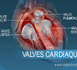 Nouakchott accueille la première édition du forum sur les maladies des valves cardiaques