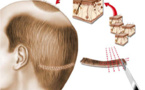 Implantation de l’UPR : Sur fond de succession ouverte Implantation de l’UPR : Sur fond de succession ouverte