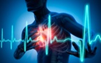 ÉclaIrcissement du Centre national de Cardiologie