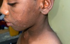 Mauritanie : Sévices sur un descendant d’esclaves, âgé de 13 ans